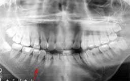 ���Ȏ���