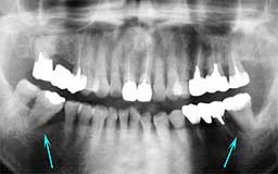 ���Ȏ���