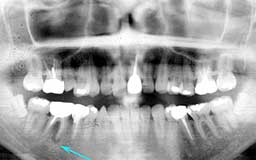 ���Ȏ���