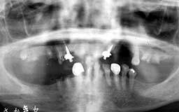 ���Ȏ���