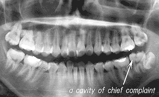 Dentistry medical treatment