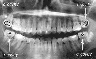 Dentistry medical treatment