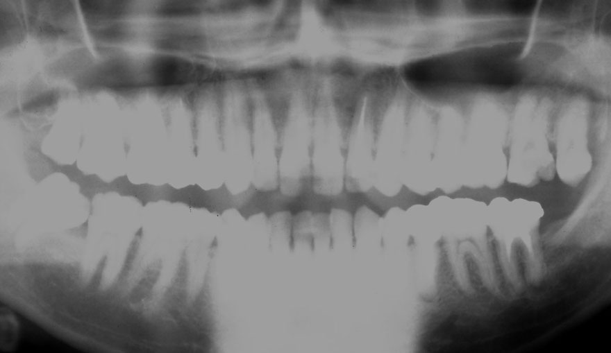 �͓c���Ȉ�@