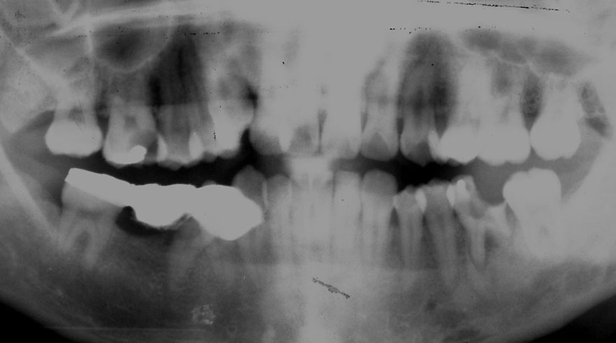 �͓c���Ȉ�@