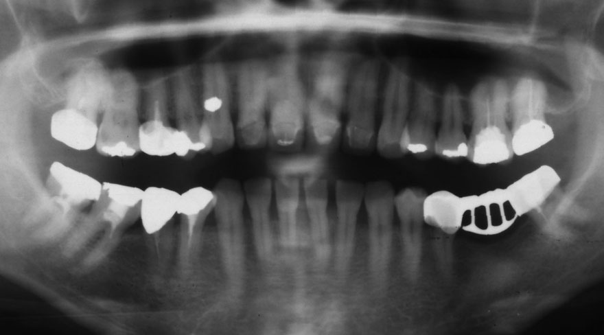 �͓c���Ȉ�@