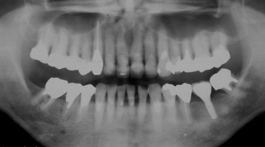 �͓c���Ȉ�@