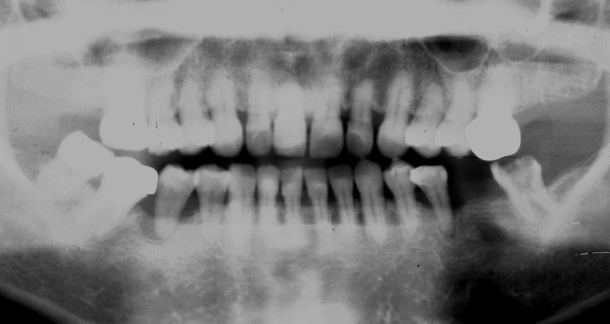 �͓c���Ȉ�@