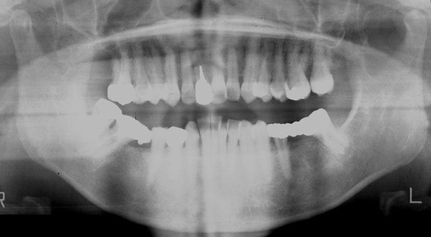 �͓c���Ȉ�@