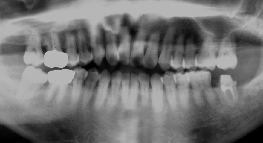 �͓c���Ȉ�@