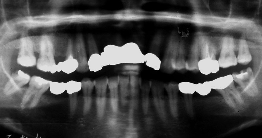 �͓c���Ȉ�@