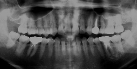 �͓c���Ȉ�@