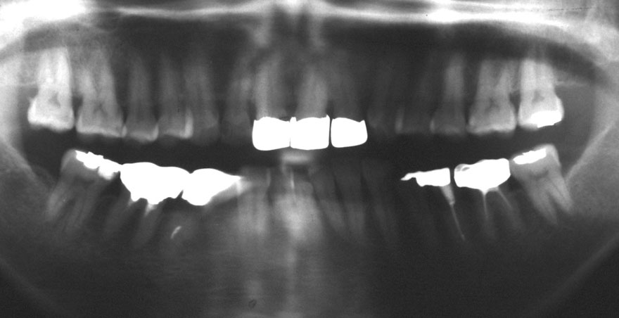 �͓c���Ȉ�@