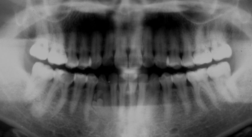 �͓c���Ȉ�@