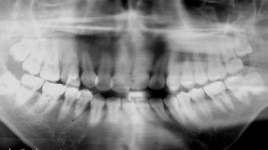 �͓c���Ȉ�@