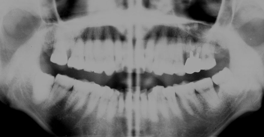 �͓c���Ȉ�@