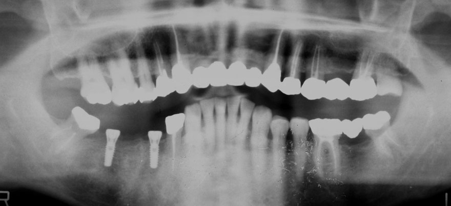 �͓c���Ȉ�@