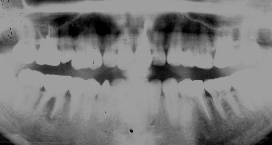 �͓c���Ȉ�@