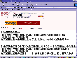 コンピュータ