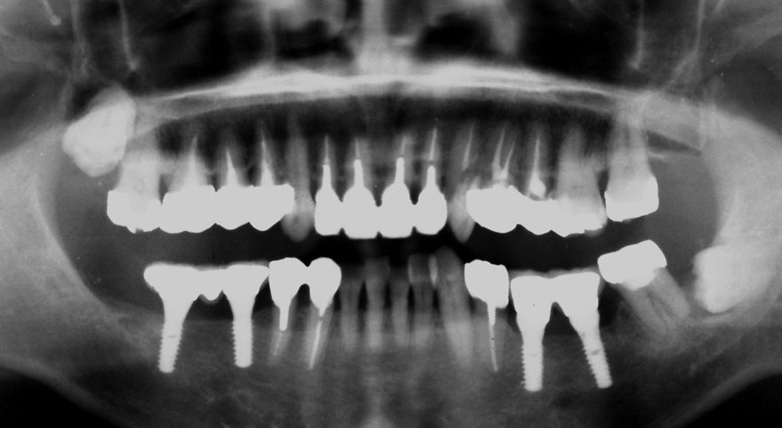 �͓c���Ȉ�@