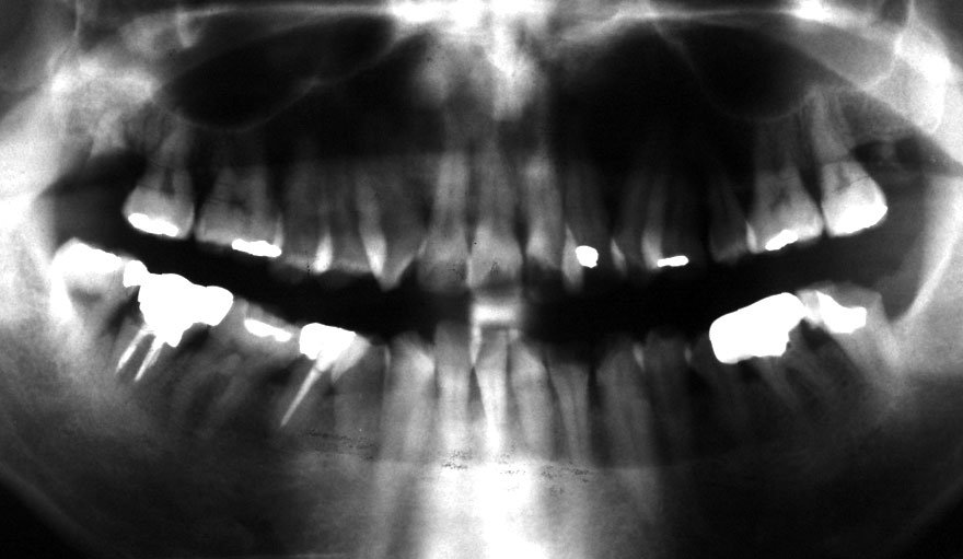 �͓c���Ȉ�@