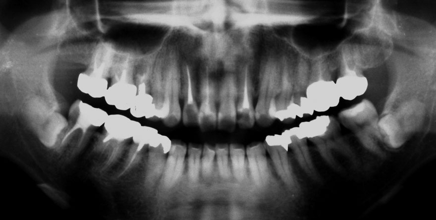 �͓c���Ȉ�@