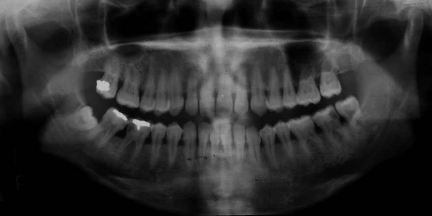 �͓c���Ȉ�@