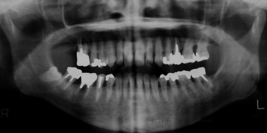 �͓c���Ȉ�@