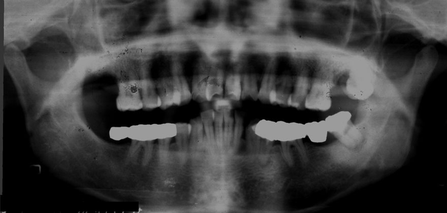 �͓c���Ȉ�@