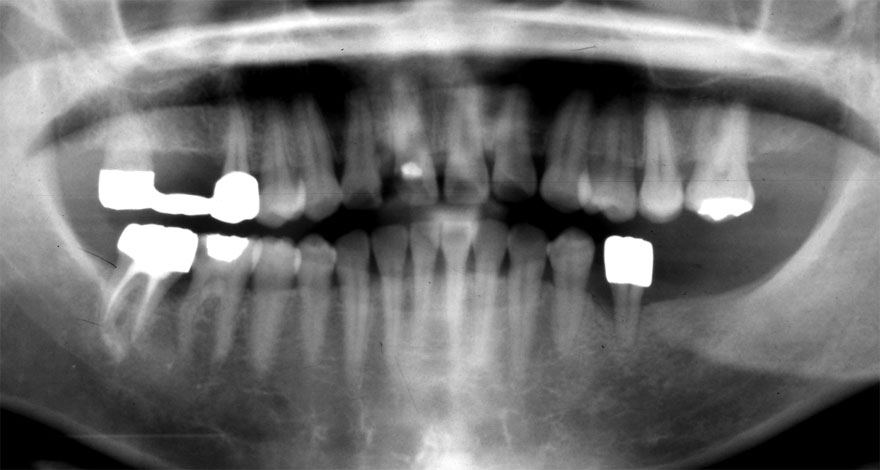 �͓c���Ȉ�@