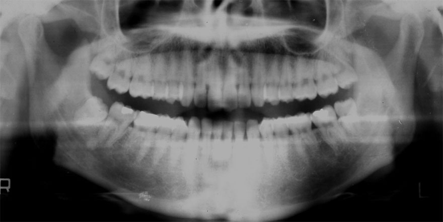 �͓c���Ȉ�@