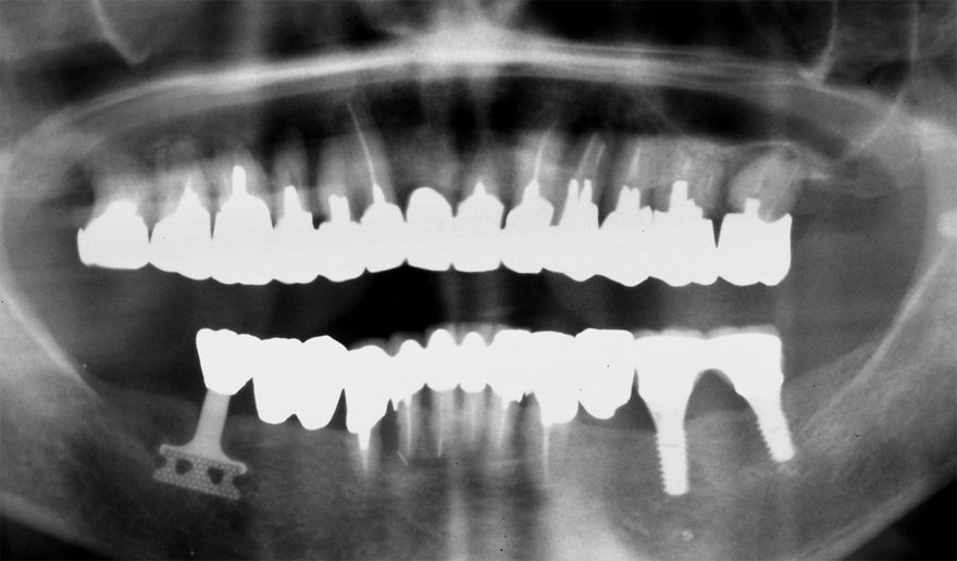 �͓c���Ȉ�@