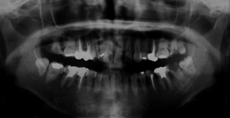 �͓c���Ȉ�@