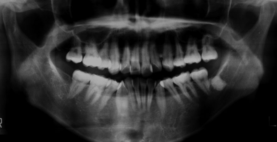 �͓c���Ȉ�@