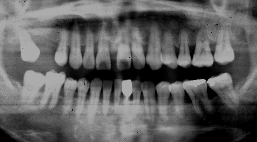 �͓c���Ȉ�@