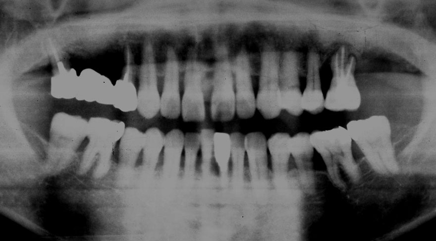 �͓c���Ȉ�@