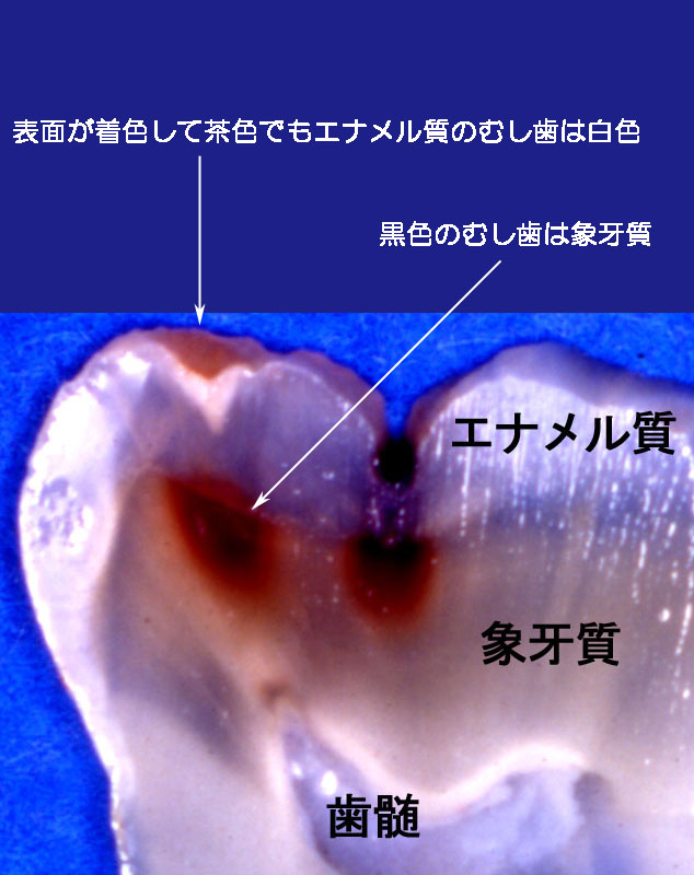 �͓c���Ȉ�@