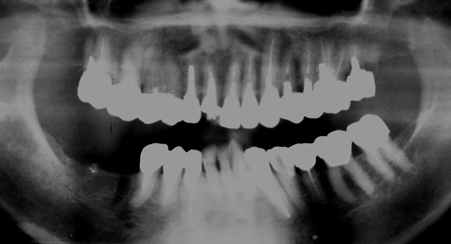 �͓c���Ȉ�@