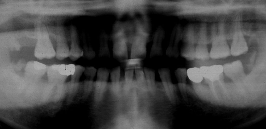 �͓c���Ȉ�@