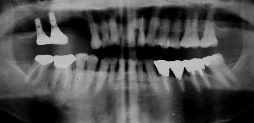 �͓c���Ȉ�@