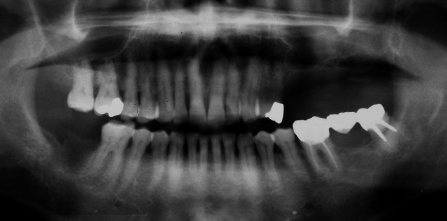 �͓c���Ȉ�@