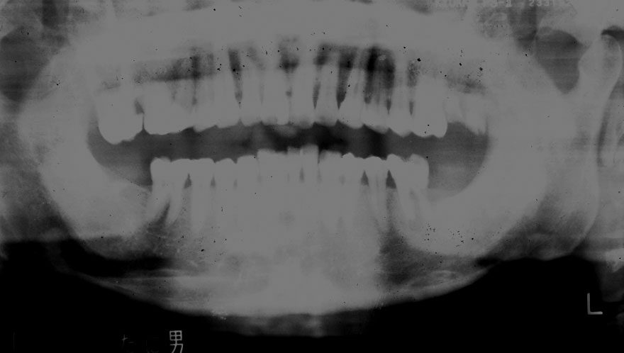 �͓c���Ȉ�@