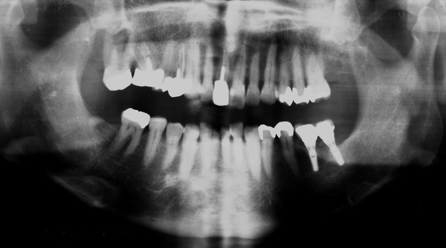 �͓c���Ȉ�@