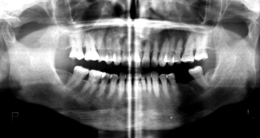 �͓c���Ȉ�@