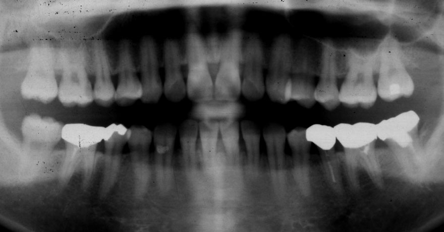 �͓c���Ȉ�@