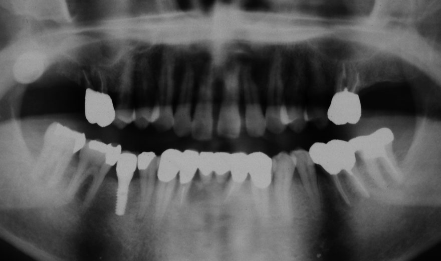 �͓c���Ȉ�@