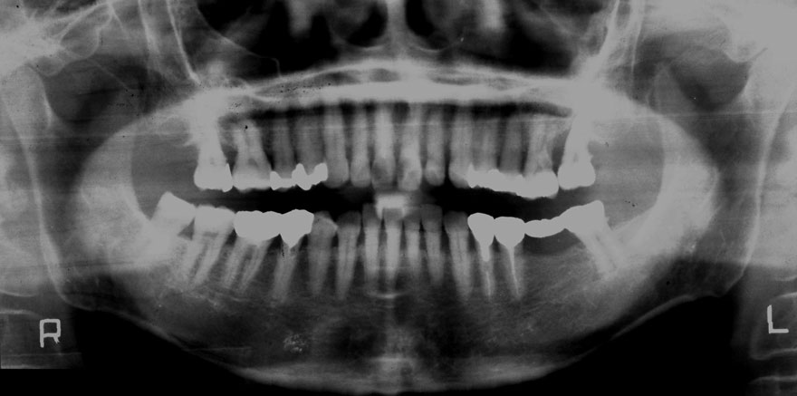 �͓c���Ȉ�@