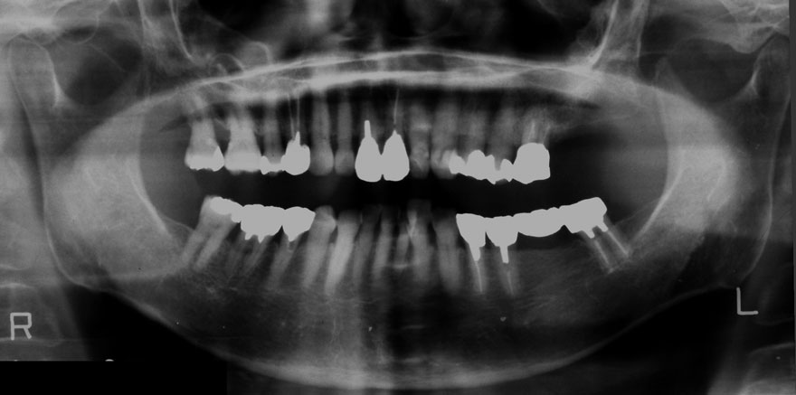 �͓c���Ȉ�@