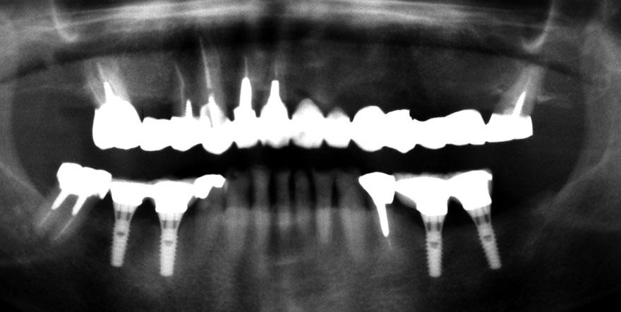 �͓c���Ȉ�@