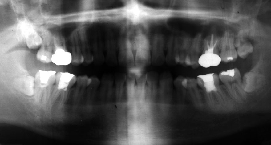 �͓c���Ȉ�@