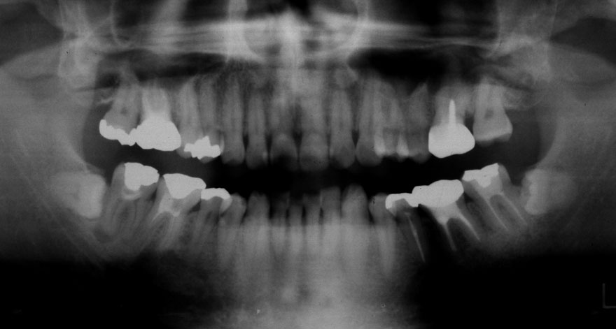 �͓c���Ȉ�@